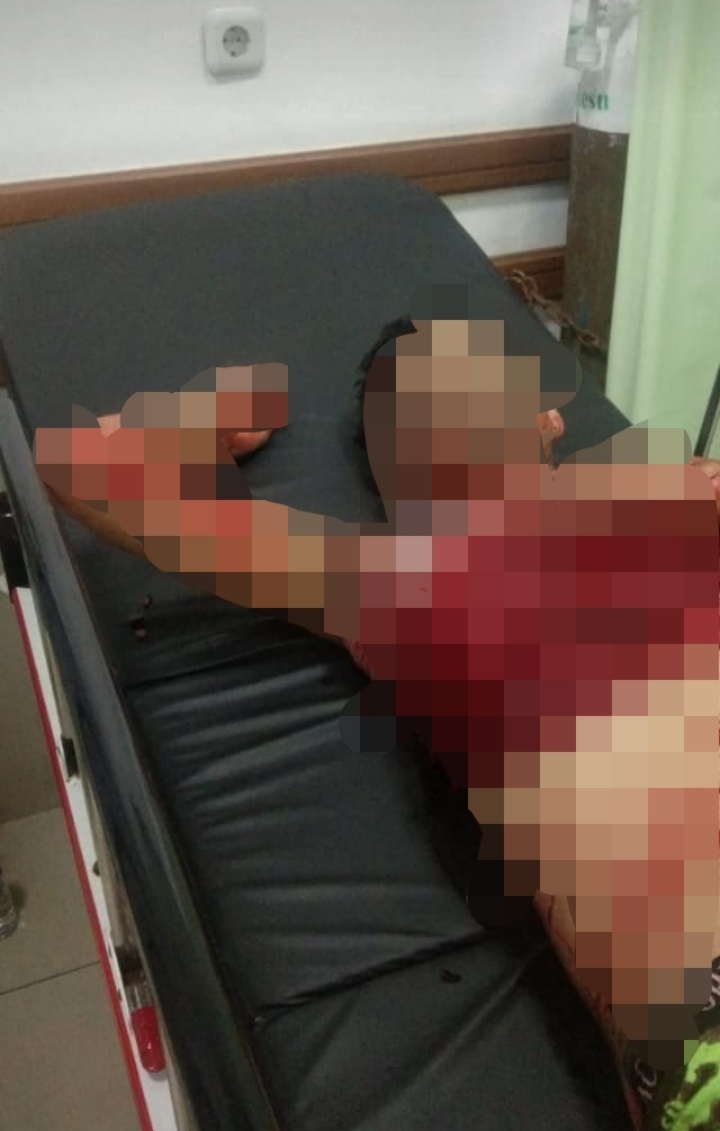 Tersangka Pelaku Pembacokan Di Daerah Galur Jakarta Pusat Diduga Melarikan diri dan Masih Buron