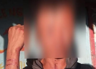 Gerak Cepat, Polisi Tangkap Tiga Orang Pelaku Pengeroyokan Pemuda Disabilitas