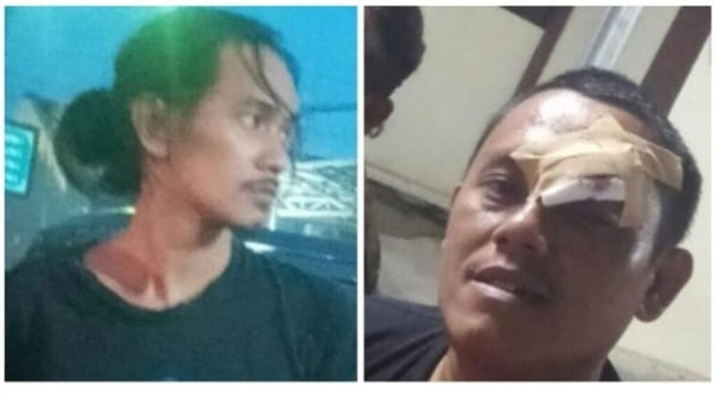 Dua Orang Wartawan Di Kabupaten Karawang Di Aniaya, PWI Jabar Desak Pihak Kepolisian Usut Tuntas