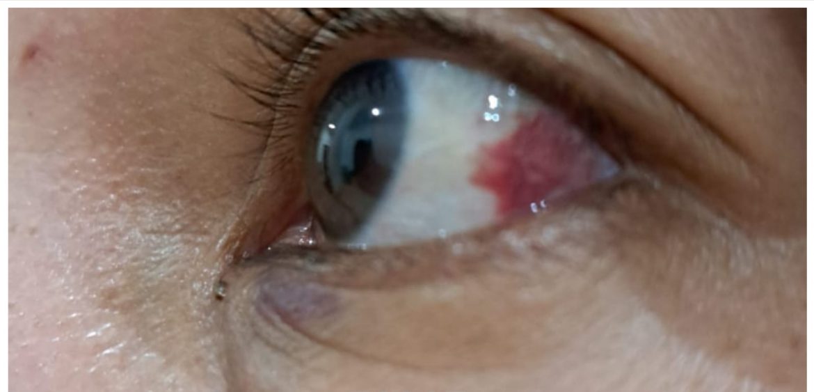 KDRT, Suami Penganiaya Istri di Bogor Terancam 5 Tahun Penjara