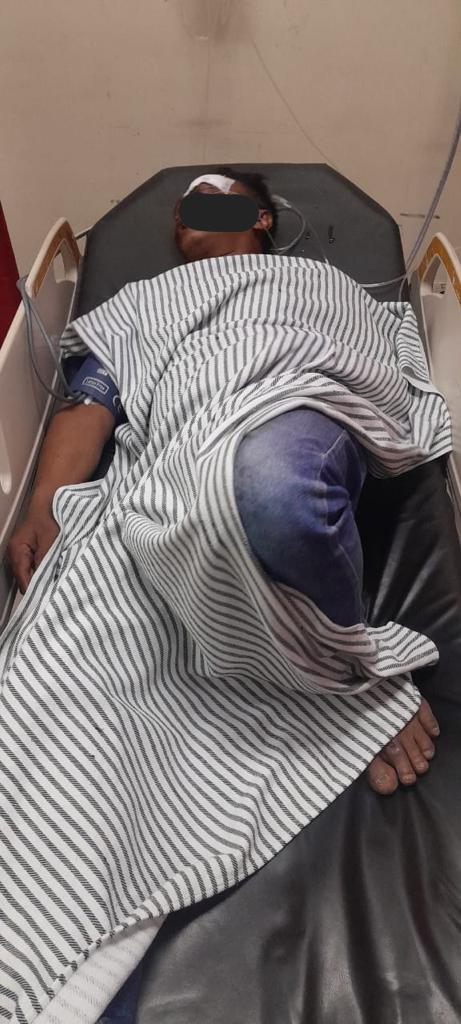 Dua Pengendara Motor Alami Laka Tunggal, Pihak Kepolisian Gelar Olah TKP