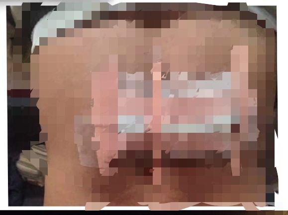 Buruh Alami Luka Robek Akibat Serangan Golok Dugaan Penganiayaan Polsek Cigudeg Lakukan Investigasi Penyelidikan Lebih Lanjut