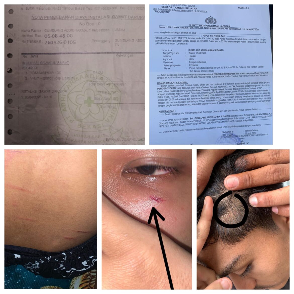 Remaja di Tambun Selatan Diduga Dikeroyok, Keluarga Tempuh Jalur Hukum